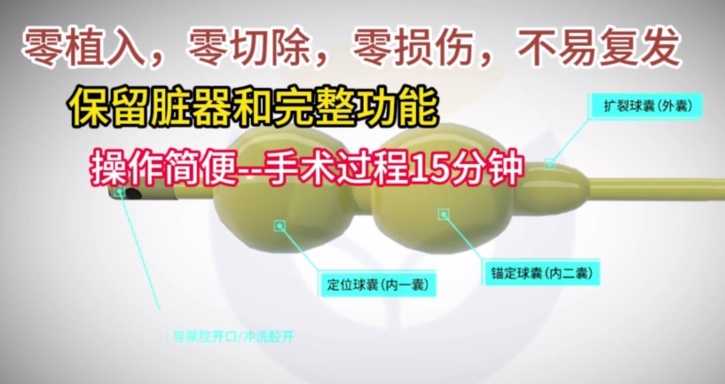 前列腺健康咨询